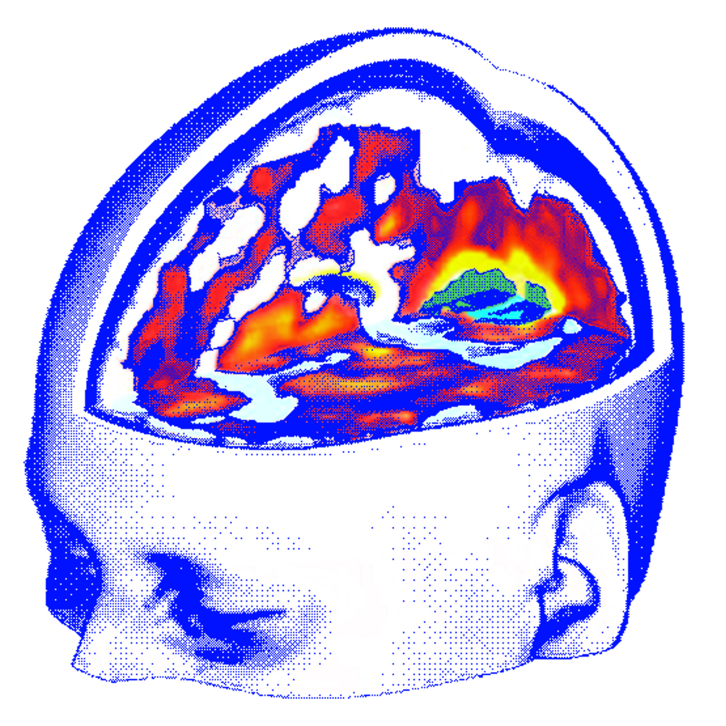 Big_Brain-Sticker